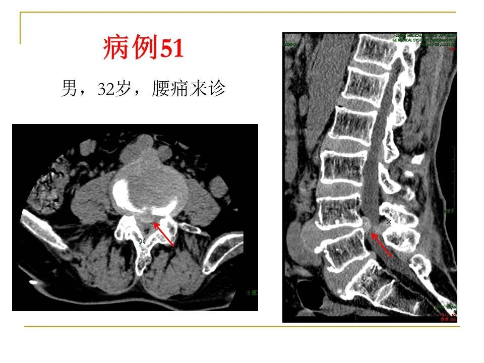 影像PPT - 【PPT】临床专业住院医师结业技能考核-165
