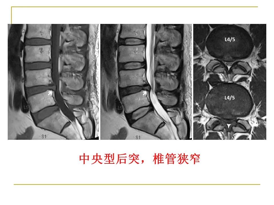影像PPT - 【PPT】临床专业住院医师结业技能考核-166