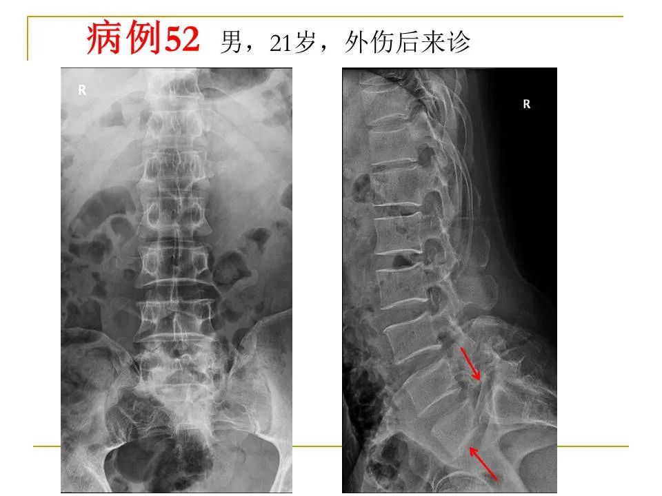 影像PPT - 【PPT】临床专业住院医师结业技能考核-168