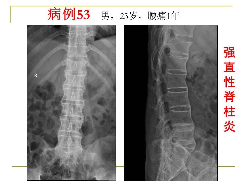 影像PPT - 【PPT】临床专业住院医师结业技能考核-169