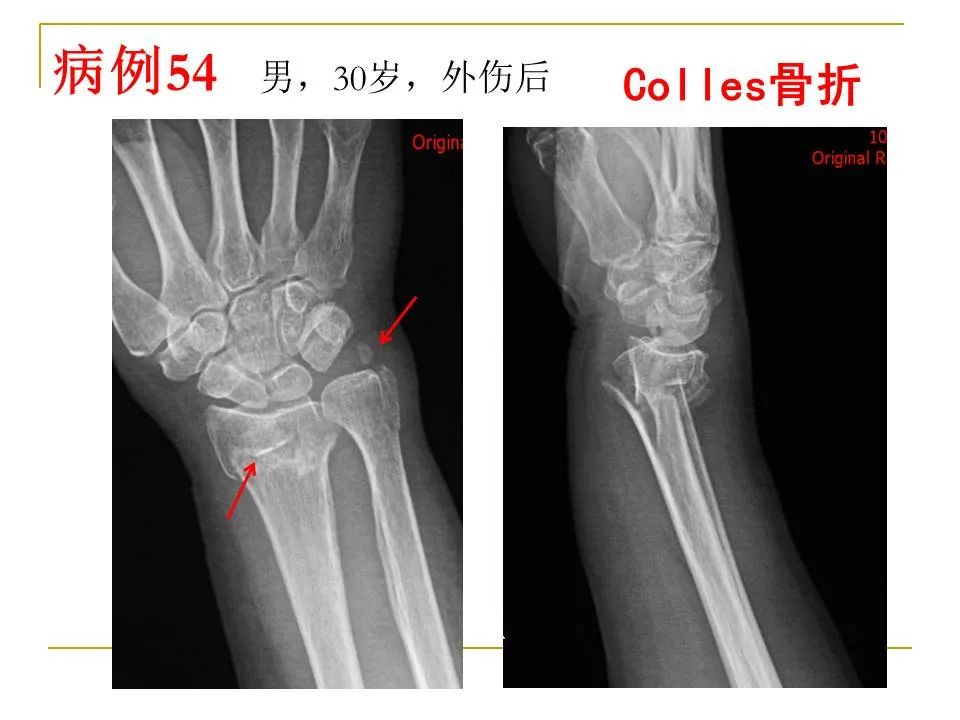 影像PPT - 【PPT】临床专业住院医师结业技能考核-170