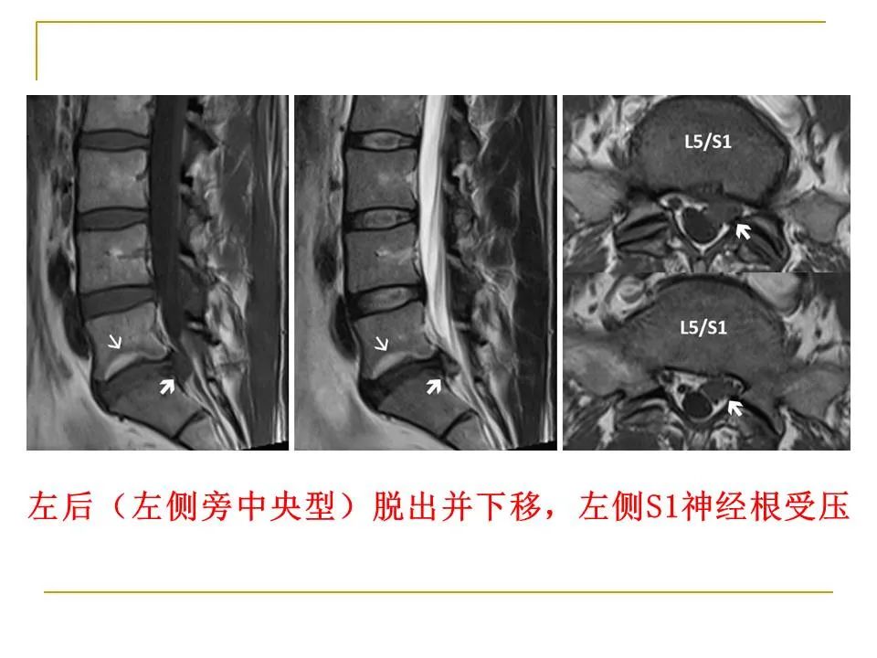 影像PPT - 【PPT】临床专业住院医师结业技能考核-167