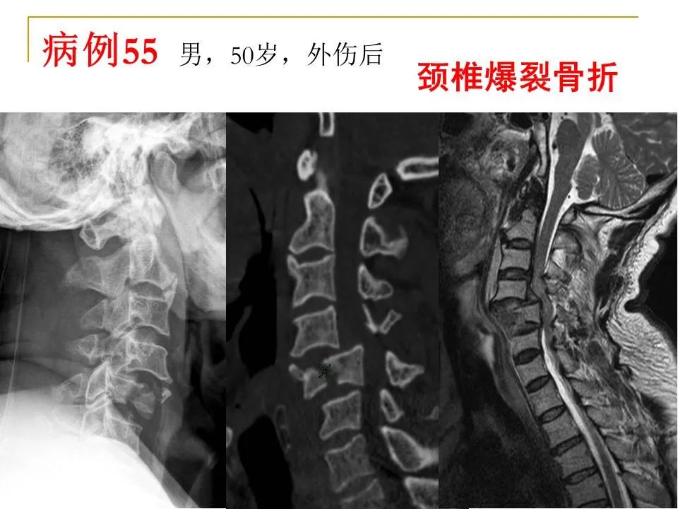 影像PPT - 【PPT】临床专业住院医师结业技能考核-171