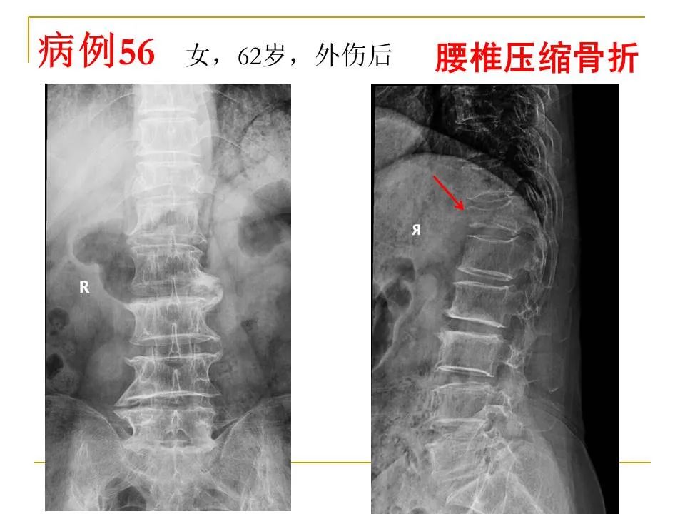 影像PPT - 【PPT】临床专业住院医师结业技能考核-172