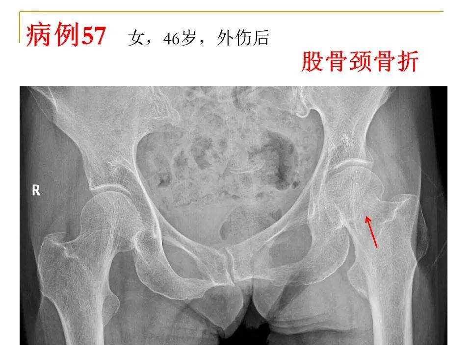 影像PPT - 【PPT】临床专业住院医师结业技能考核-173