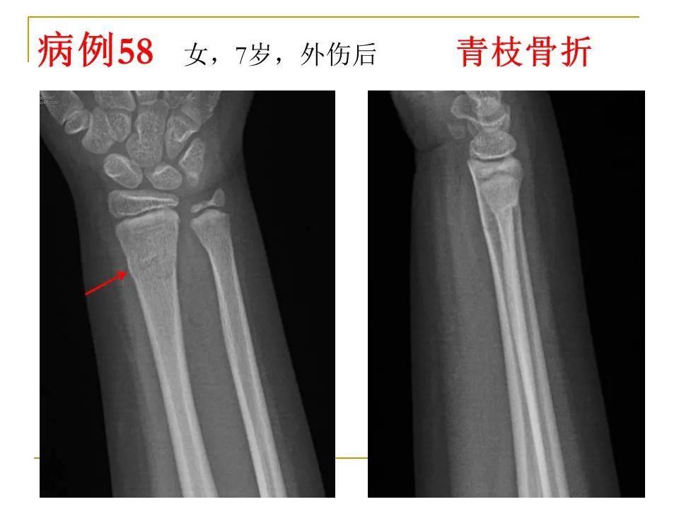 影像PPT - 【PPT】临床专业住院医师结业技能考核-175