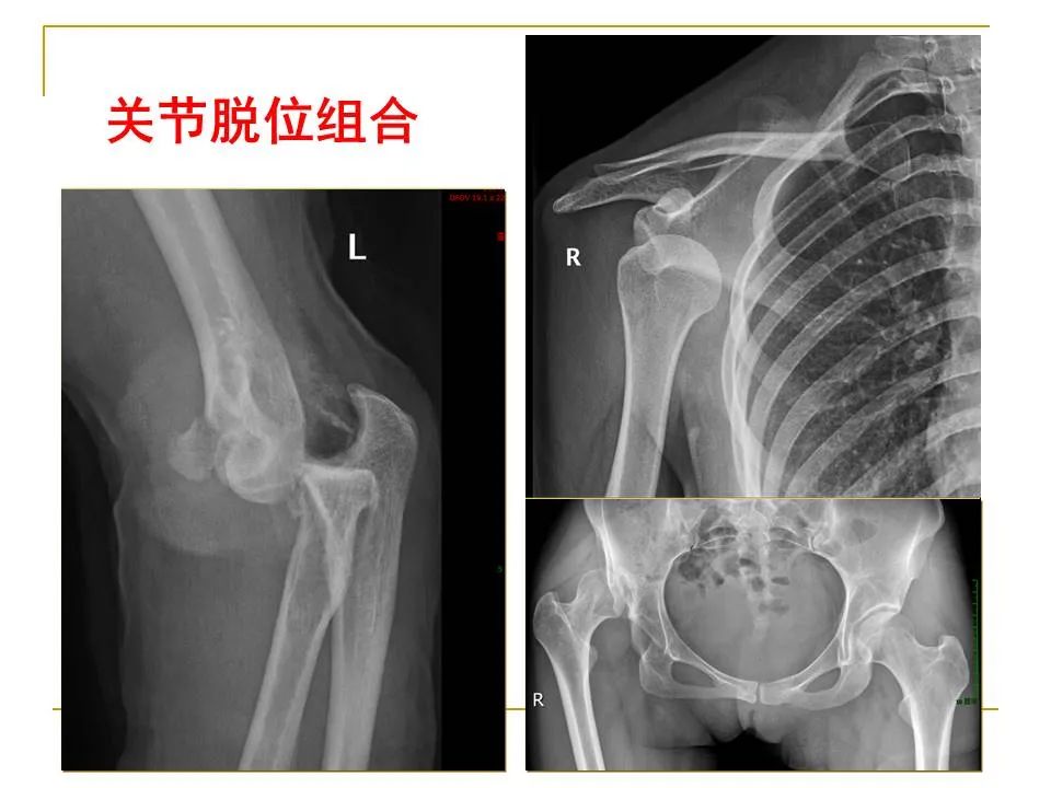 影像PPT - 【PPT】临床专业住院医师结业技能考核-174