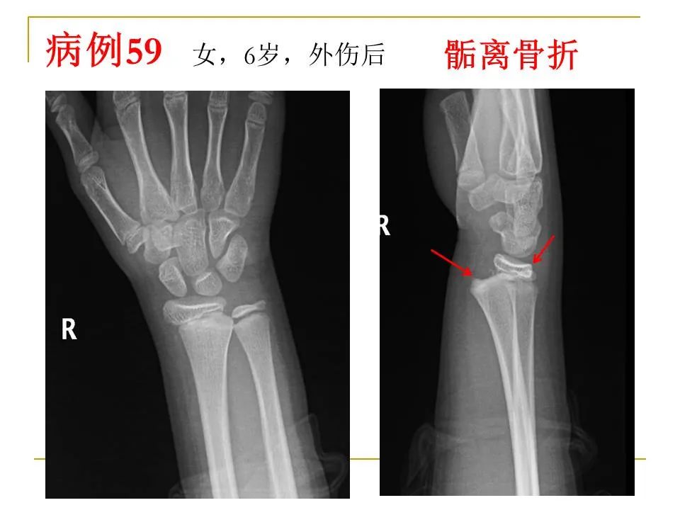 影像PPT - 【PPT】临床专业住院医师结业技能考核-176