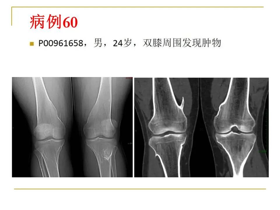 影像PPT - 【PPT】临床专业住院医师结业技能考核-177