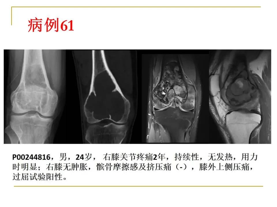 影像PPT - 【PPT】临床专业住院医师结业技能考核-181