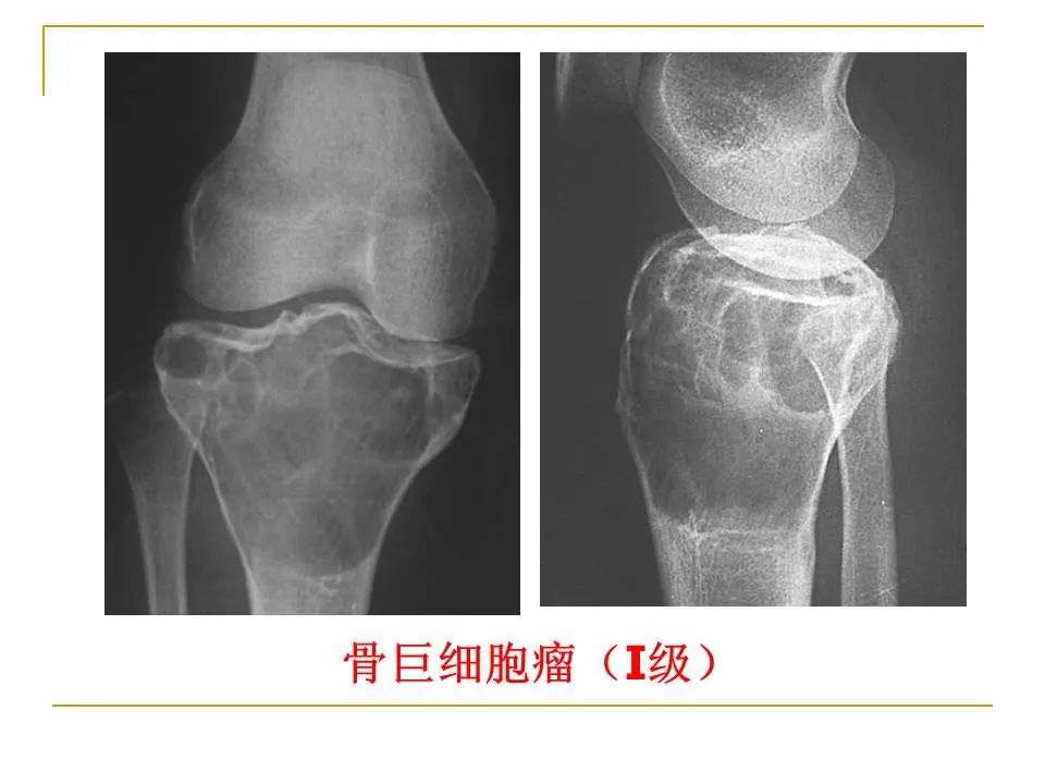 影像PPT - 【PPT】临床专业住院医师结业技能考核-183