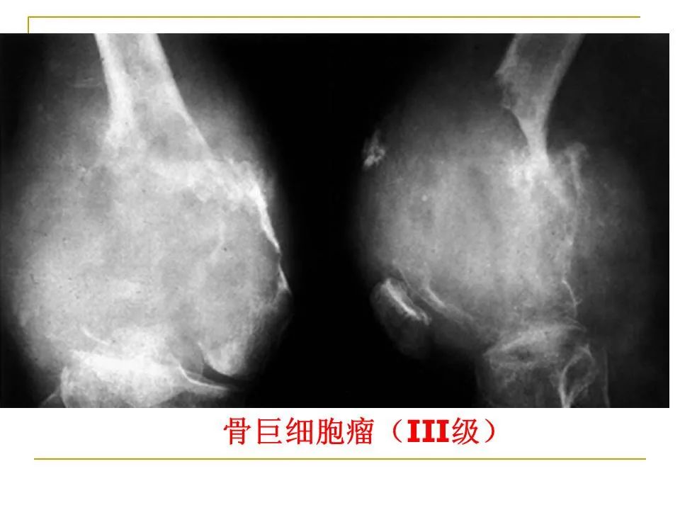 影像PPT - 【PPT】临床专业住院医师结业技能考核-185