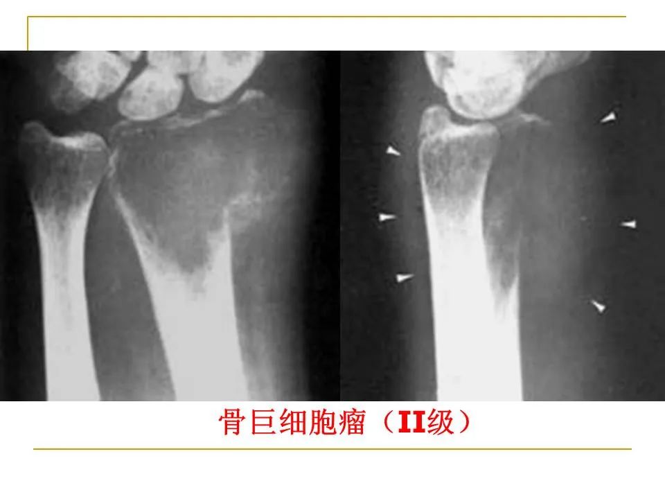 影像PPT - 【PPT】临床专业住院医师结业技能考核-184