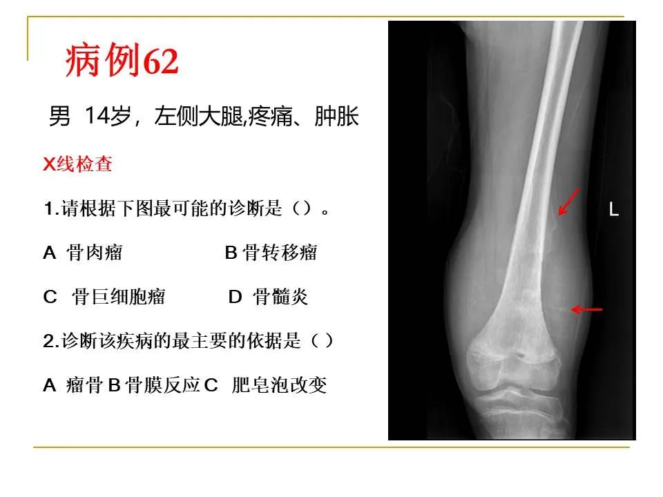影像PPT - 【PPT】临床专业住院医师结业技能考核-186