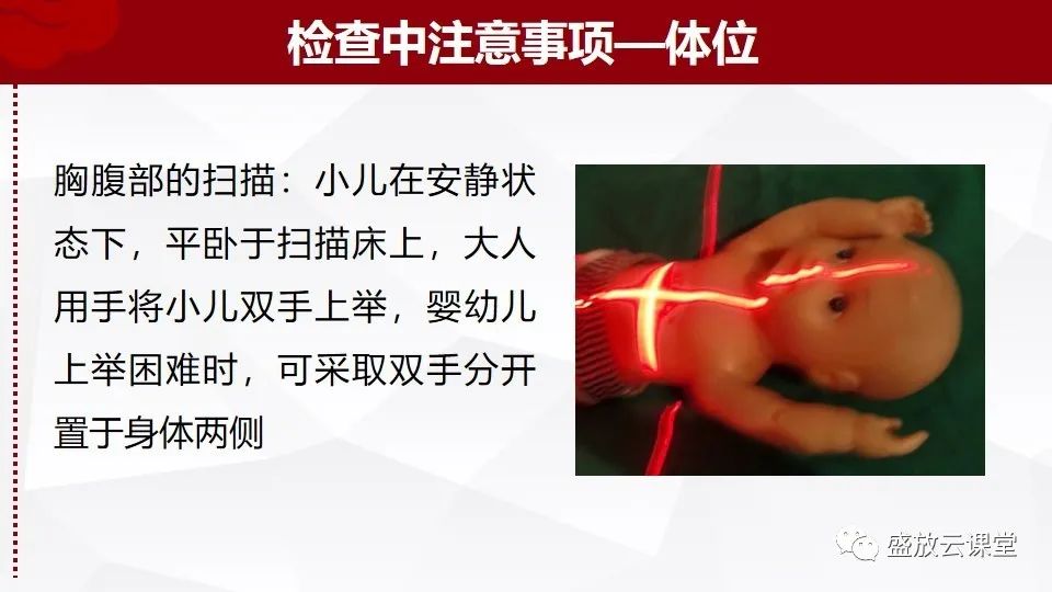 影像PPT - 【PPT】小儿增强CT检查注意事项-18