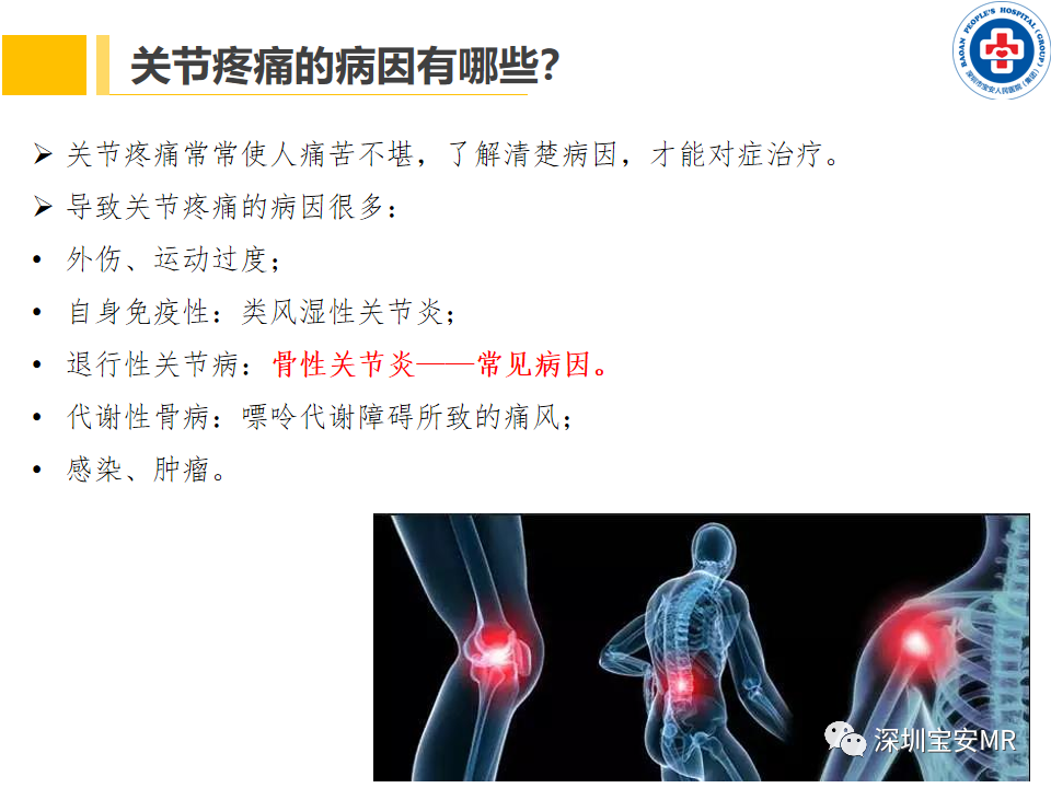 影像PPT - 【PPT】常见疾病—骨性关节炎磁共振检查-2