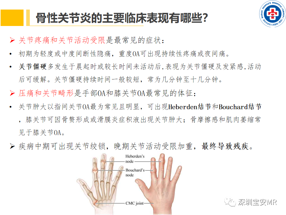 影像PPT - 【PPT】常见疾病—骨性关节炎磁共振检查-5