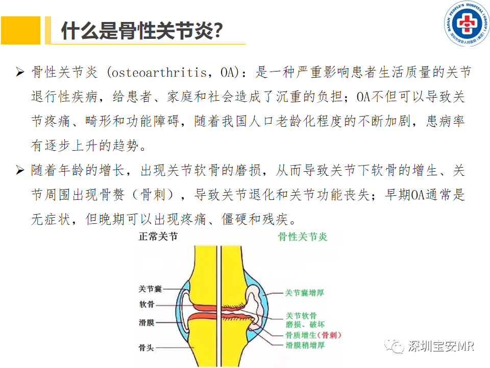 影像PPT - 【PPT】常见疾病—骨性关节炎磁共振检查-3
