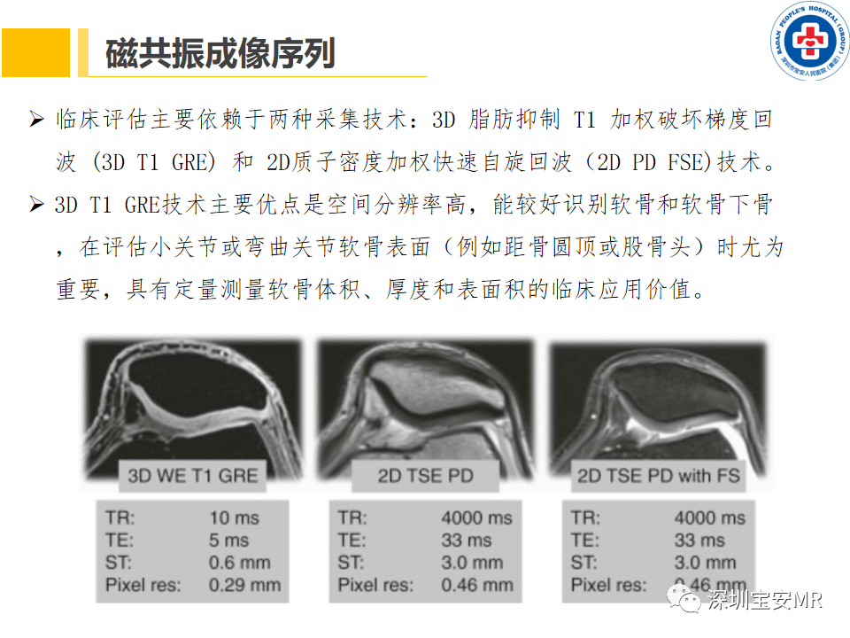 影像PPT - 【PPT】常见疾病—骨性关节炎磁共振检查-10