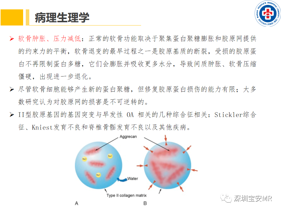 影像PPT - 【PPT】常见疾病—骨性关节炎磁共振检查-8
