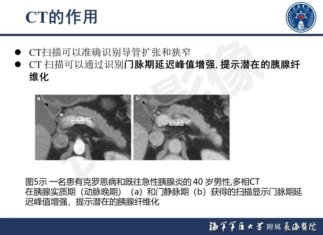 影像PPT - 【PPT】基于横断面成像来评估慢性胰腺炎严重程度：为什么有必要和如何进行-12