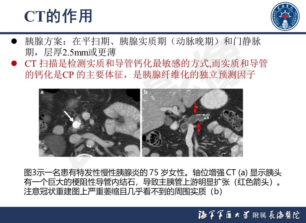影像PPT - 【PPT】基于横断面成像来评估慢性胰腺炎严重程度：为什么有必要和如何进行-10