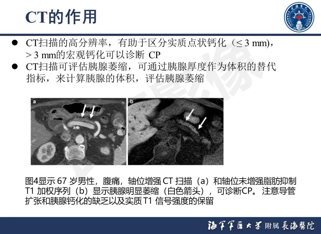 影像PPT - 【PPT】基于横断面成像来评估慢性胰腺炎严重程度：为什么有必要和如何进行-11