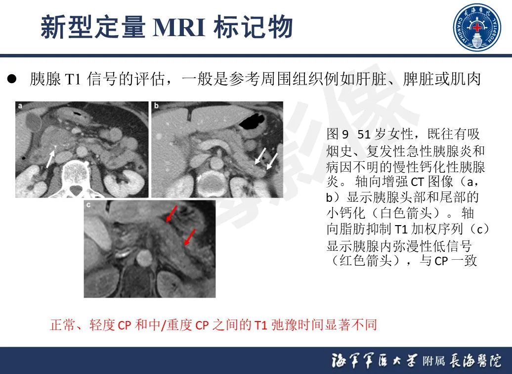 影像PPT - 【PPT】基于横断面成像来评估慢性胰腺炎严重程度：为什么有必要和如何进行-16