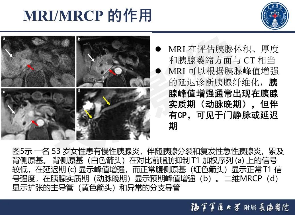影像PPT - 【PPT】基于横断面成像来评估慢性胰腺炎严重程度：为什么有必要和如何进行-13