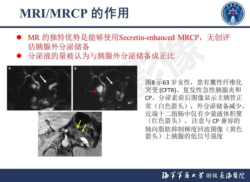 影像PPT - 【PPT】基于横断面成像来评估慢性胰腺炎严重程度：为什么有必要和如何进行-15