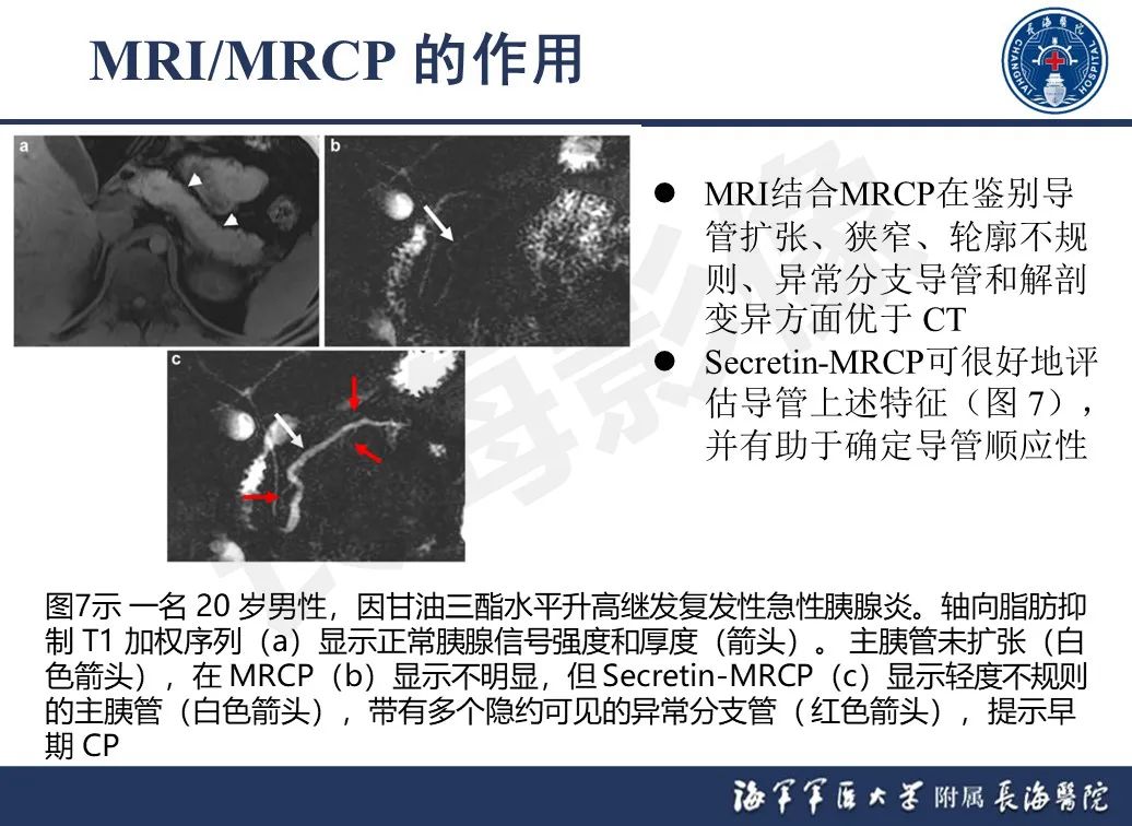 影像PPT - 【PPT】基于横断面成像来评估慢性胰腺炎严重程度：为什么有必要和如何进行-14