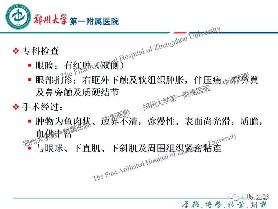 影像PPT - 【PPT】眼眶淋巴瘤的MRI诊断-29