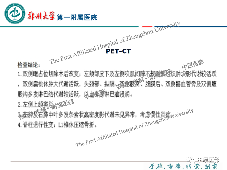 影像PPT - 【PPT】眼眶淋巴瘤的MRI诊断-53