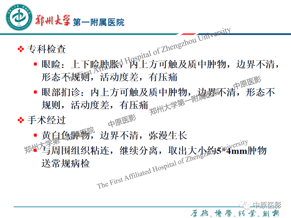 影像PPT - 【PPT】眼眶淋巴瘤的MRI诊断-35