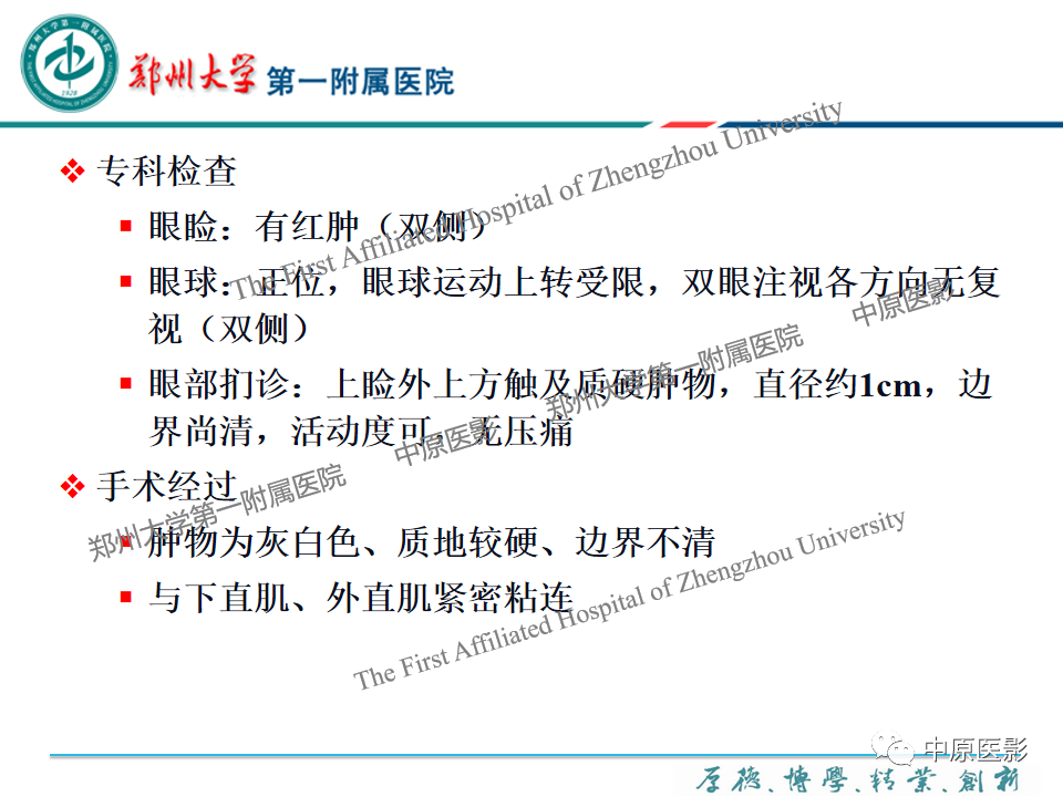 影像PPT - 【PPT】眼眶淋巴瘤的MRI诊断-56