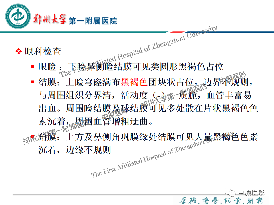 影像PPT - 【PPT】眼眶淋巴瘤的MRI诊断-84