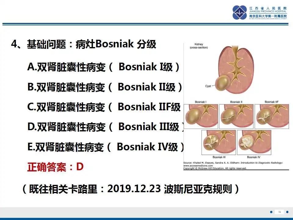 影像PPT - 【PPT】克唑替尼相关性肾囊肿-20