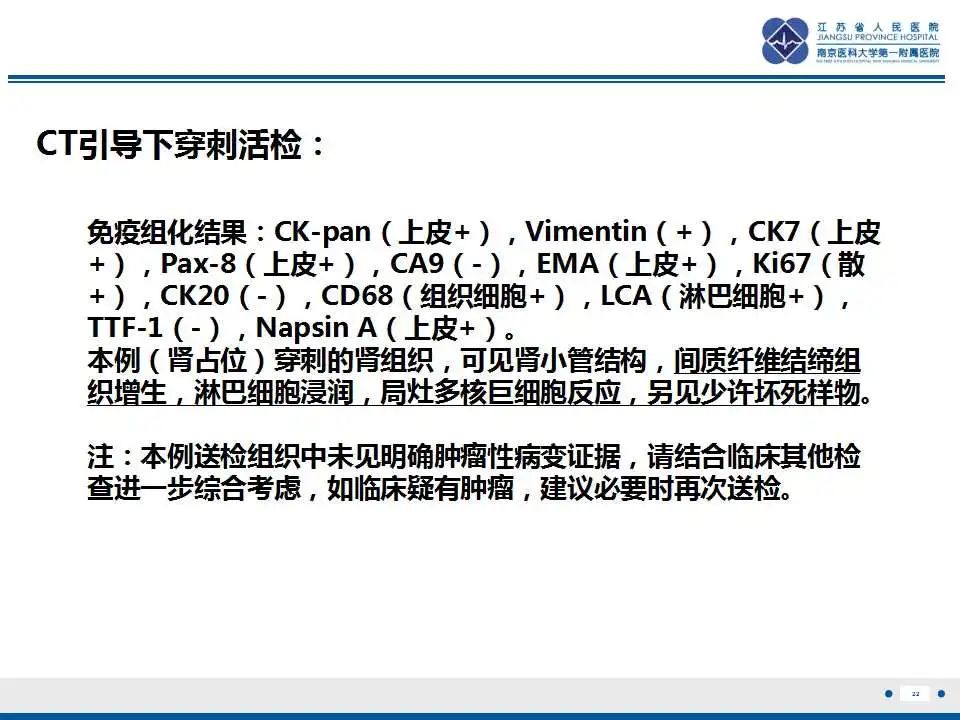 影像PPT - 【PPT】克唑替尼相关性肾囊肿-23