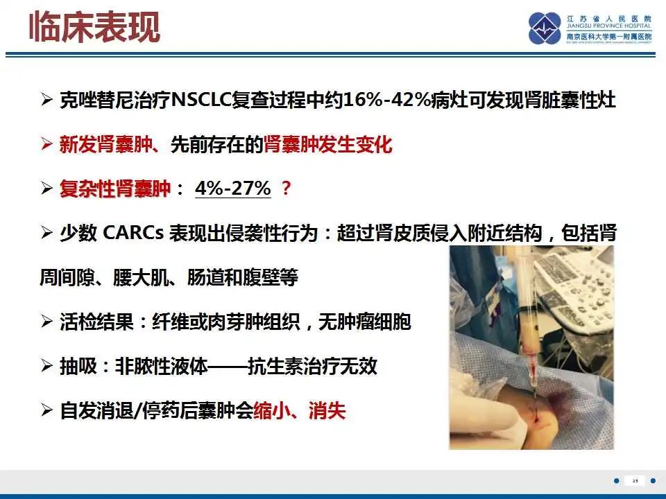 影像PPT - 【PPT】克唑替尼相关性肾囊肿-26
