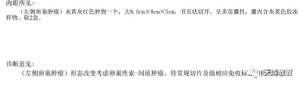 影像PPT - 【病例】卵巢性索间质肿瘤—卵泡膜细胞纤维瘤1例MR-10 影像PPT - 【病例】卵巢性索间质肿瘤—卵泡膜细胞纤维瘤1例MR-10