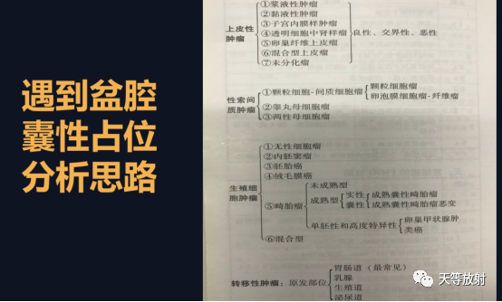 影像PPT - 【病例】卵巢性索间质肿瘤—卵泡膜细胞纤维瘤1例MR-11 影像PPT - 【病例】卵巢性索间质肿瘤—卵泡膜细胞纤维瘤1例MR-11