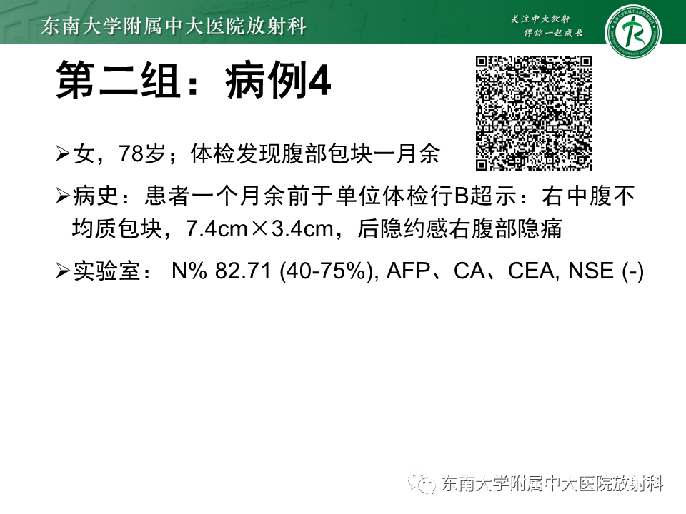 影像PPT - 【PPT】病例讨论：小肠恶性肿瘤-6