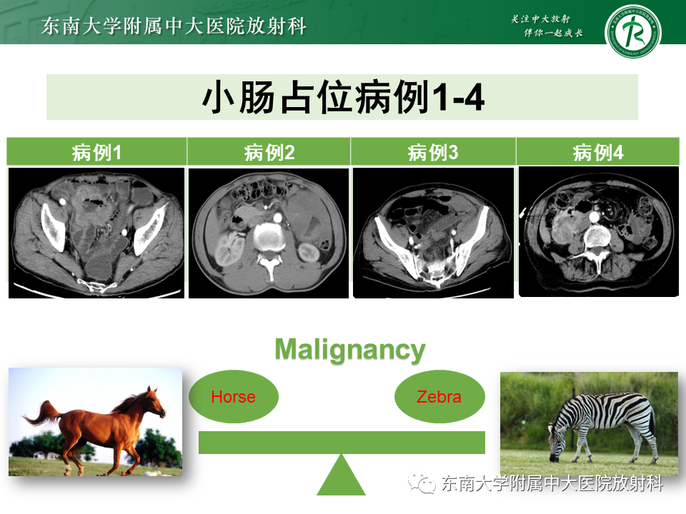 影像PPT - 【PPT】病例讨论：小肠恶性肿瘤-2