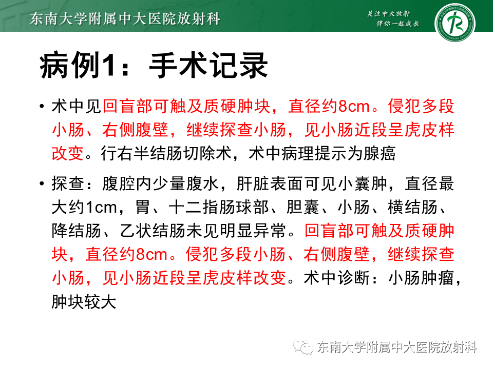 影像PPT - 【PPT】病例讨论：小肠恶性肿瘤-19