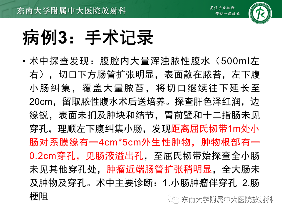 影像PPT - 【PPT】病例讨论：小肠恶性肿瘤-29