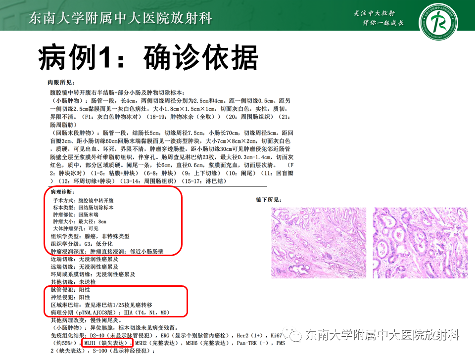 影像PPT - 【PPT】病例讨论：小肠恶性肿瘤-20