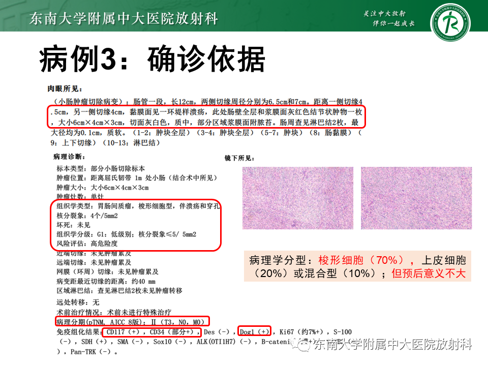 影像PPT - 【PPT】病例讨论：小肠恶性肿瘤-30
