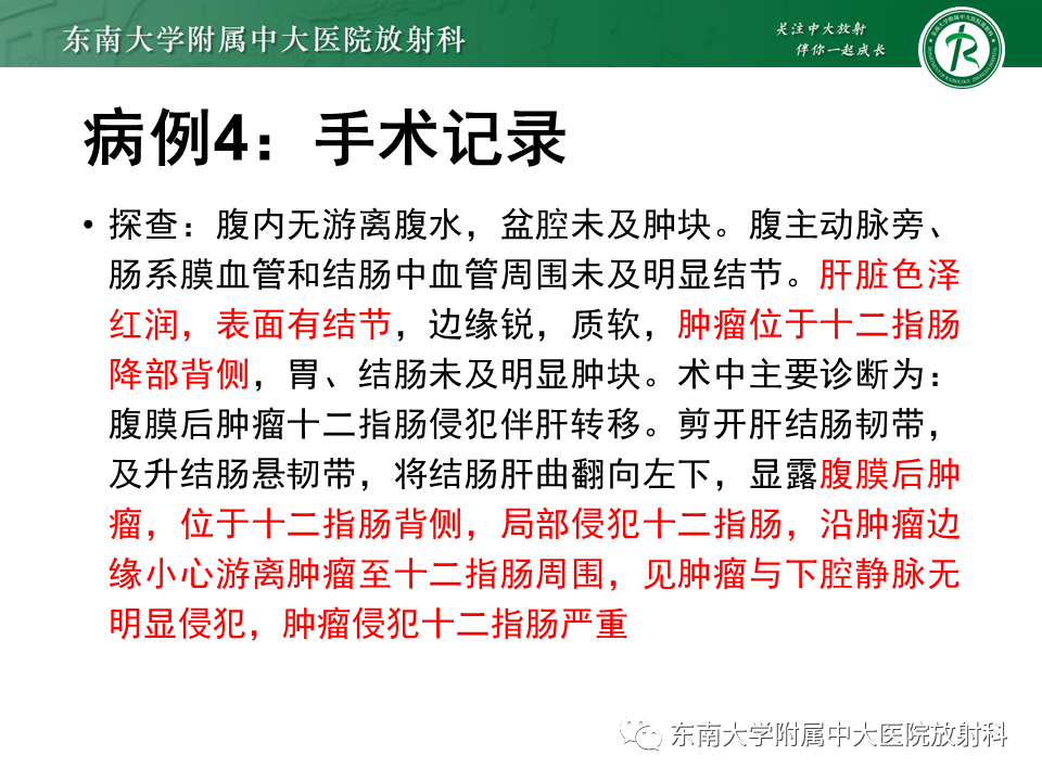 影像PPT - 【PPT】病例讨论：小肠恶性肿瘤-34