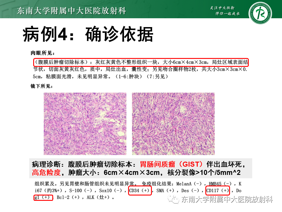 影像PPT - 【PPT】病例讨论：小肠恶性肿瘤-35