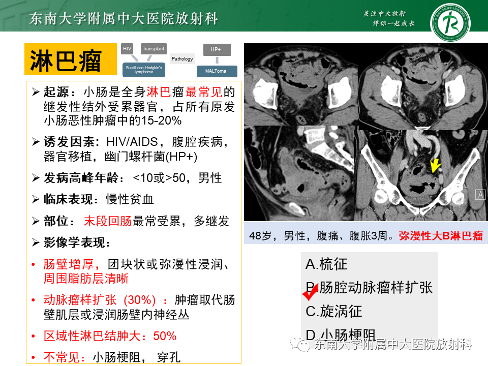 影像PPT - 【PPT】病例讨论：小肠恶性肿瘤-41
